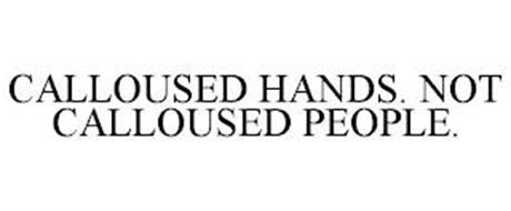 CALLOUSED HANDS. NOT CALLOUSED PEOPLE.